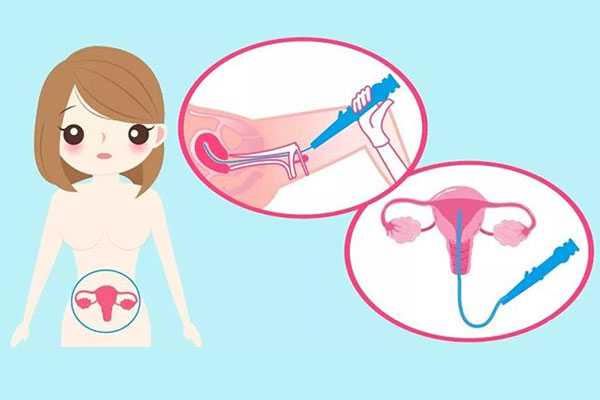 香港验血测孩子性别准吗,子宫肌瘤会影响到试管婴儿成功率嘛?