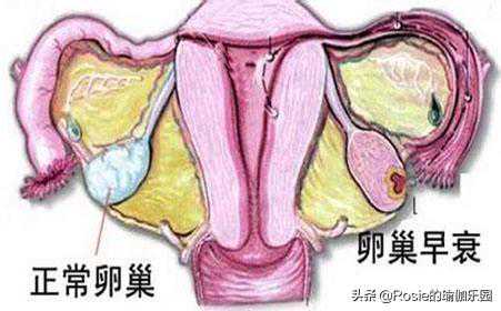 香港验血测性别的根据是什么,备孕期男性喝酒有影响吗