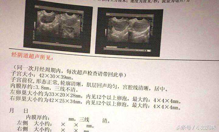多少天可以香港验血,独家发布 | 双胞胎宝妈备孕秘籍，大曝光！