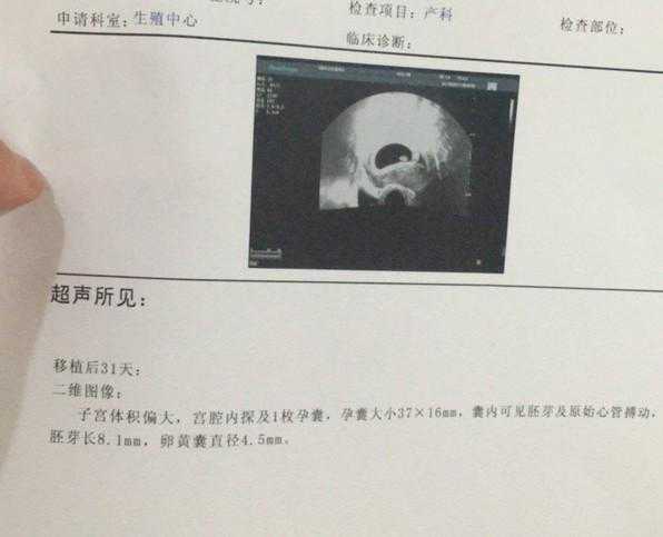 疫情期间能邮寄香港验血吗,做试管婴儿解冻6年前冻坯胎，“双胞胎”相差6岁
