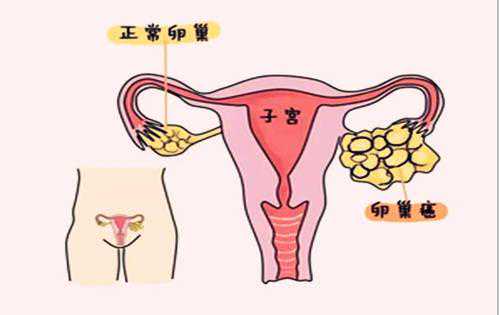 怀孕40多天香港验血无Y,不孕不育排查法以及男性不孕不育自测