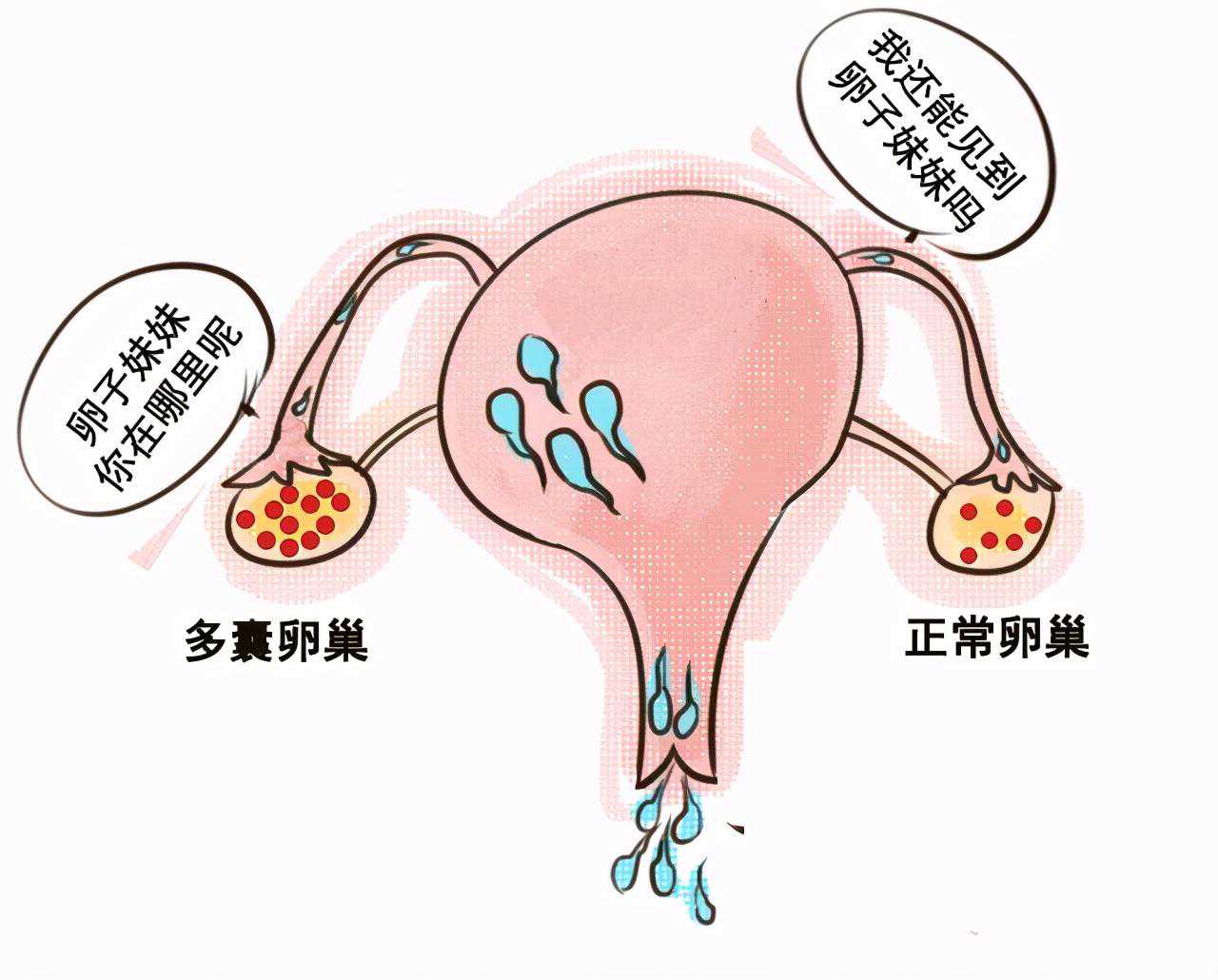 香港验血过关要问怀孕,多囊卵巢备孕心得