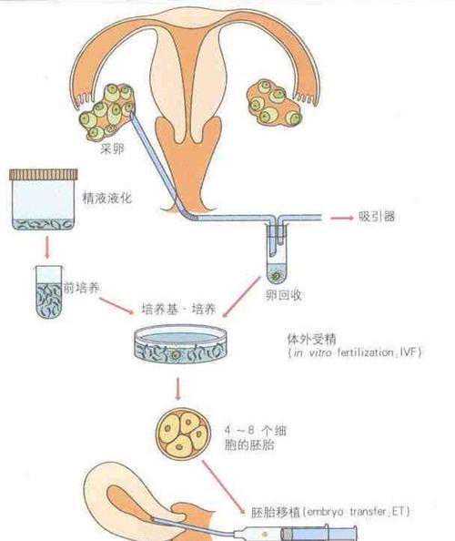 怀孕一个多月去香港验血查男女,试管婴儿过程的详细解析，了解下