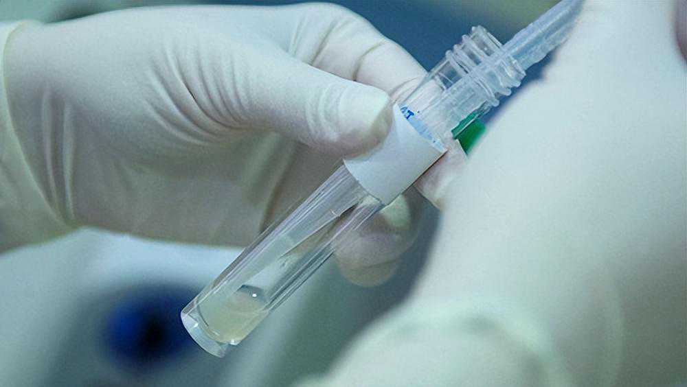 香港化验血检验性别,27岁男子，精子有点弱，备孕几年没孩子，人工授精怎么样