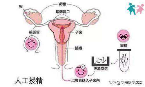 香港验血报告看男女准吗,人工授精和试管婴儿并不是一回事?想要生孩子,备孕夫