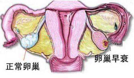 需要多久才可以香港验血男女,卵巢早衰，26岁的女孩提前进入更年期，备孕4年
