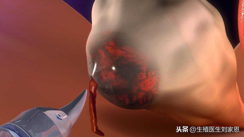 香港验血七周能做吗,41岁准妈妈6年试管助孕求子记：大龄女性备孕有没有捷径