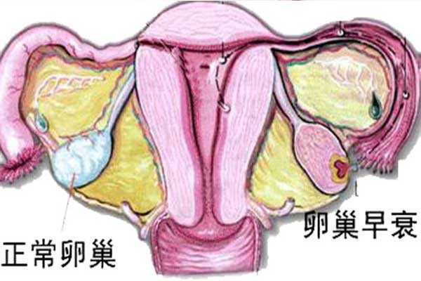 几周香港验血准吗,卵巢早衰想备孕能治好吗？